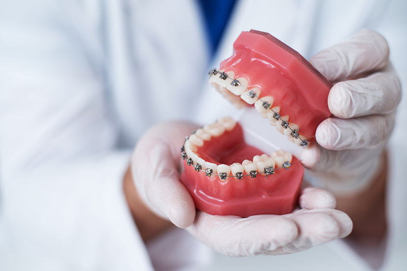 orthodontist-holding-teeth-model-with-braces